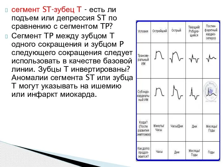 сегмент ST-зубец T - есть ли подъем или депрессия ST по сравнению