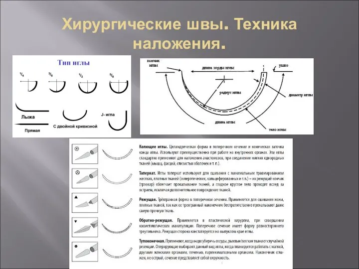 Хирургические швы. Техника наложения.