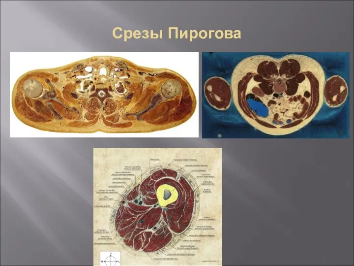 Срезы Пирогова