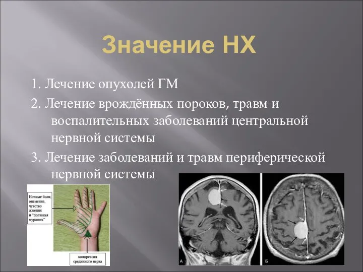 Значение НХ 1. Лечение опухолей ГМ 2. Лечение врождённых пороков, травм и