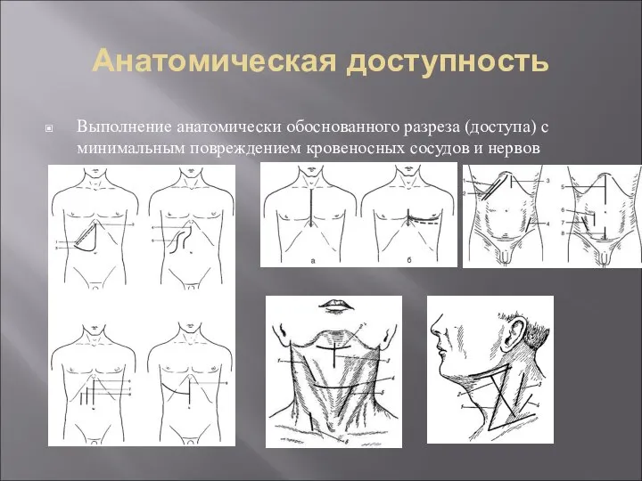 Анатомическая доступность Выполнение анатомически обоснованного разреза (доступа) с минимальным повреждением кровеносных сосудов и нервов