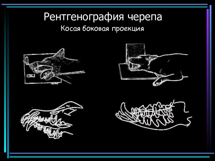 Рентгенография черепа Косая боковая проекция