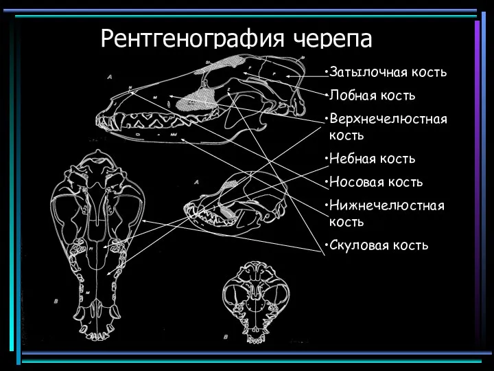 Рентгенография черепа Затылочная кость Лобная кость Верхнечелюстная кость Небная кость Носовая кость Нижнечелюстная кость Скуловая кость