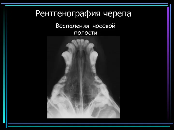 Рентгенография черепа Воспаления носовой полости