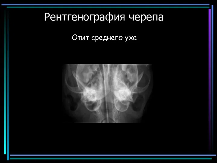Рентгенография черепа Отит среднего уха
