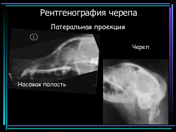 Рентгенография черепа Латеральная проекция Носовая полость Череп