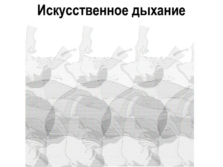 Искусственное дыхание