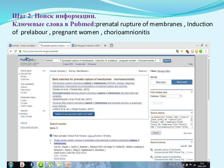 Шаг 2. Поиск информации. Ключевые слова в Pubmed:prenatal rupture of membranes ,