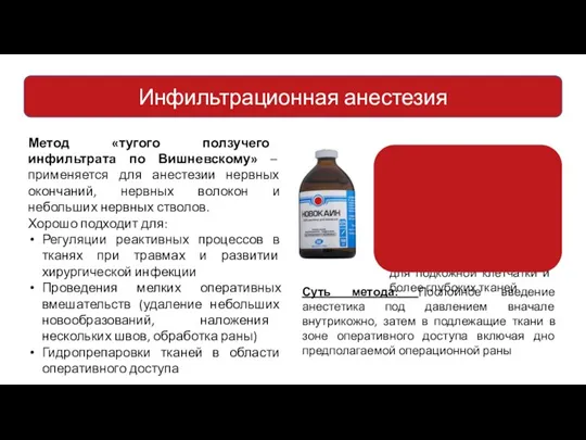 Инфильтрационная анестезия Метод «тугого ползучего инфильтрата по Вишневскому» – применяется для анестезии
