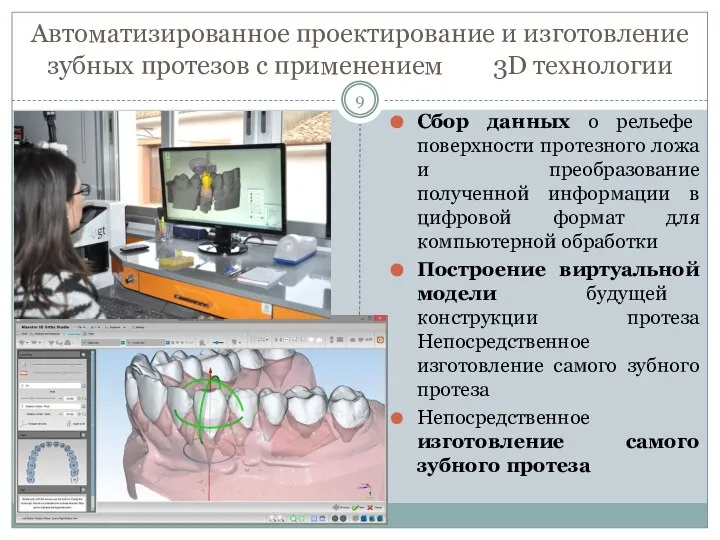 Автоматизированное проектирование и изготовление зубных протезов с применением 3D технологии Сбор данных