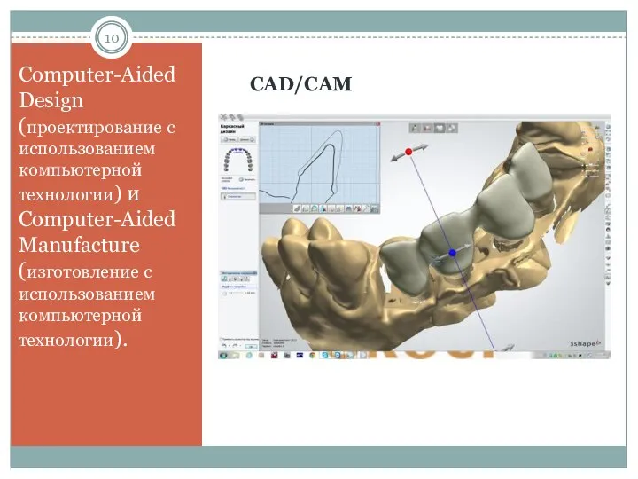 CAD/CAM Computer-Aided Design (проектирование с использованием компьютерной технологии) и Computer-Aided Manufacture (изготовление с использованием компьютерной технологии).