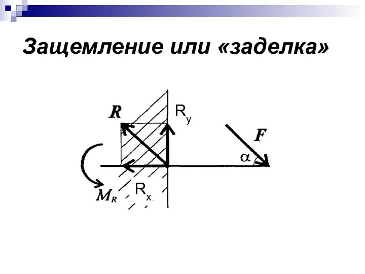 Защемление или «заделка» Ry Rx