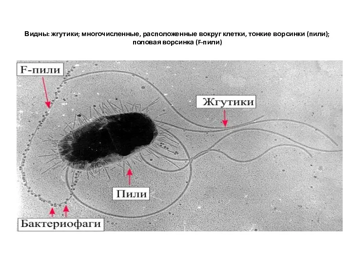 Видны: жгутики; многочисленные, расположенные вокруг клетки, тонкие ворсинки (пили); половая ворсинка (F-пили)