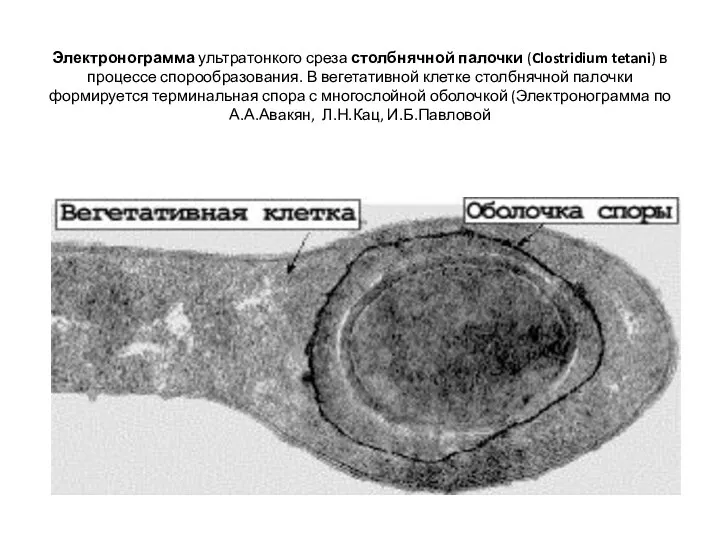 Электронограмма ультратонкого среза столбнячной палочки (Clostridium tetani) в процессе спорообразования. В вегетативной