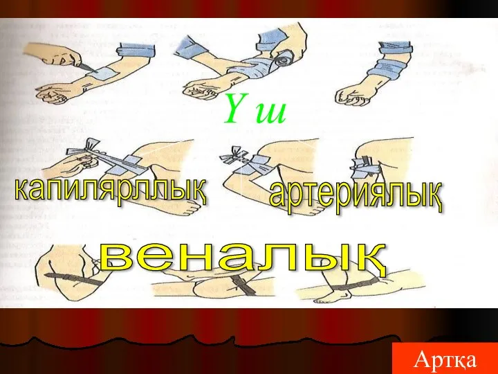 Ү ш Артқа капилярллық веналық артериялық