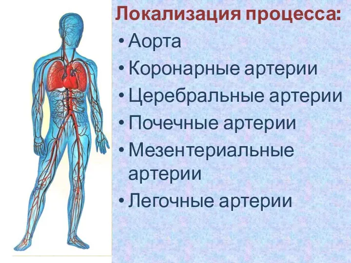 Локализация процесса: Аорта Коронарные артерии Церебральные артерии Почечные артерии Мезентериальные артерии Легочные артерии