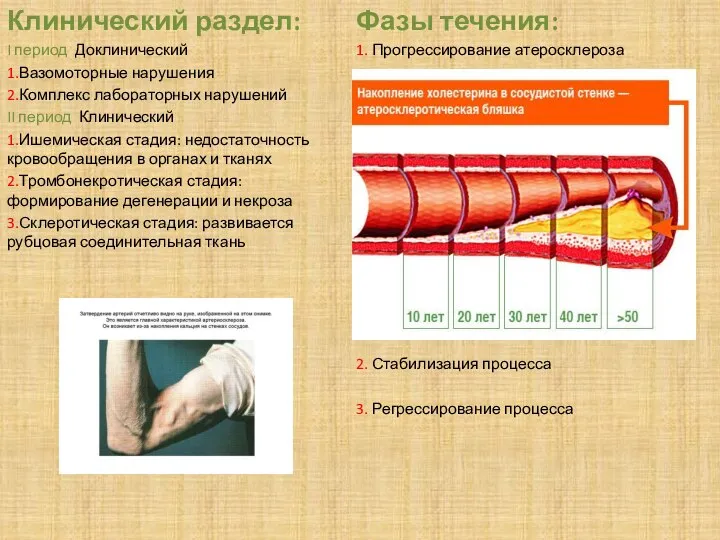 Клинический раздел: I период Доклинический 1.Вазомоторные нарушения 2.Комплекс лабораторных нарушений II период