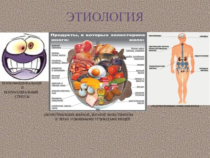 ЭТИОЛОГИЯ ПСИХОЭМОЦИОНАЛЬНЫЙ И ПСИХОСОЦИАЛЬНЫЙ СТРЕССЫ ЭНДОКРИННЫЕ ЗАБОЛЕВАНИЯ ЗЛОУПОТРЕБЛЕНИЕ ЖИРНОЙ, БОГАТОЙ ХОЛЕСТЕРИНОМ И