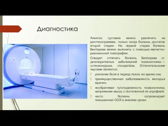 Диагностика Анкилоз суставов можно различить на рентгенограммах, только когда болезнь достигла второй