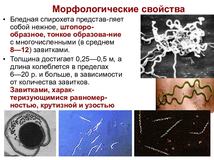 Морфологические свойства Бледная спирохета представ-ляет собой нежное, штопоро-образное, тонкое образова-ние с многочисленными