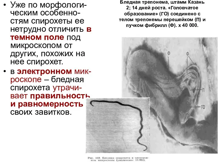 Бледная трепонема, штамм Казань 2; 14 дней роста. «Головчатое образование» (ГО) соединено