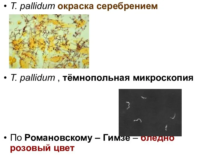 T. pallidum окраска серебрением T. pallidum , тёмнопольная микроскопия По Романовскому –