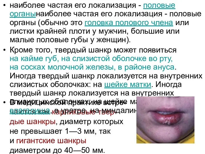 В медицинской практике встре-чаются как карликовые твер-дые шанкры, диаметр которых не превышает