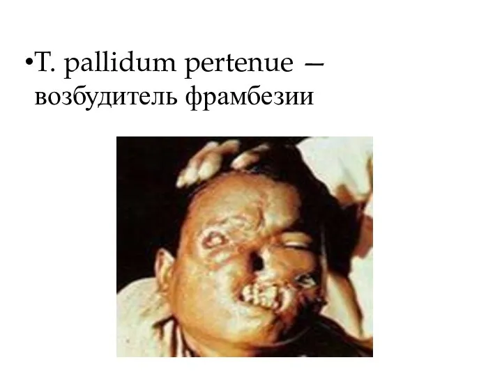 T. pallidum pertenue — возбудитель фрамбезии