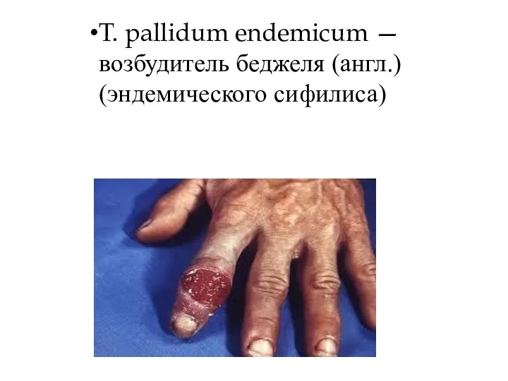 T. pallidum endemicum — возбудитель беджеля (англ.) (эндемического сифилиса)