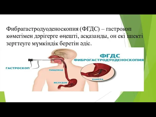 Фибрагастродуоденоскопия (ФГДС) – гастрокоп көмегімен дәрігерге өңешті, асқазанды, он екі ішекті зерттеуге мүмкіндік беретін әдіс.