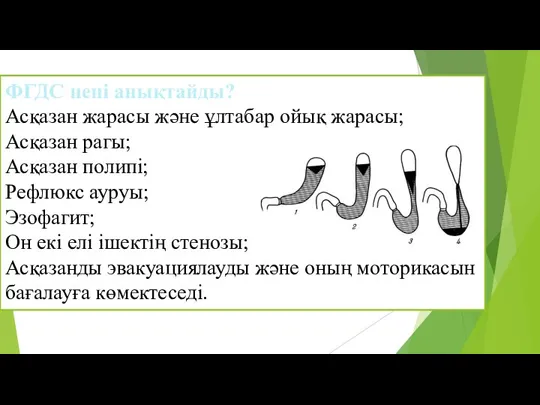 ФГДС нені анықтайды? Асқазан жарасы және ұлтабар ойық жарасы; Асқазан рагы; Асқазан