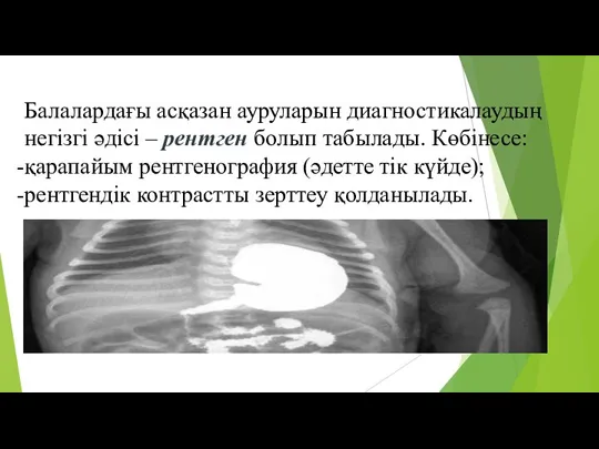 Балалардағы асқазан ауруларын диагностикалаудың негізгі әдісі – рентген болып табылады. Көбінесе: қарапайым