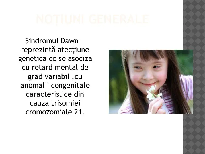 NOȚIUNI GENERALE Sindromul Dawn reprezintă afecțiune genetica ce se asociza cu retard