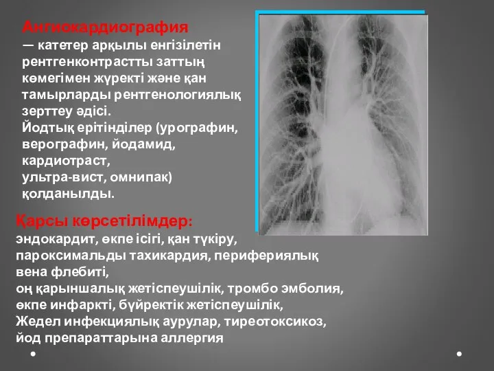 Ангиокардиография — катетер арқылы енгізілетін рентгенконтрастты заттың көмегімен жүректі және қан тамырларды