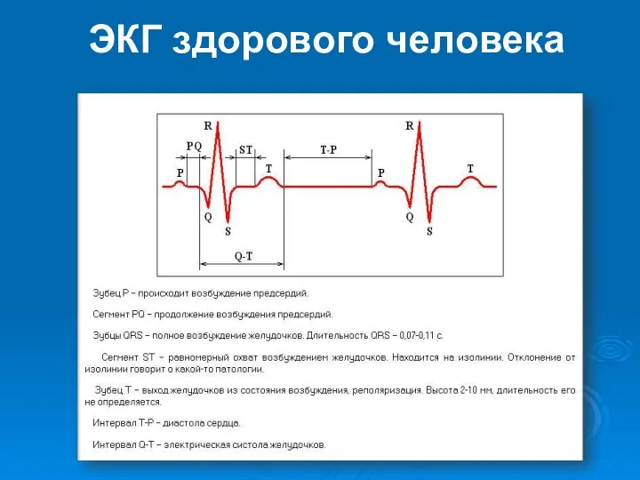 ЭКГ здорового человека