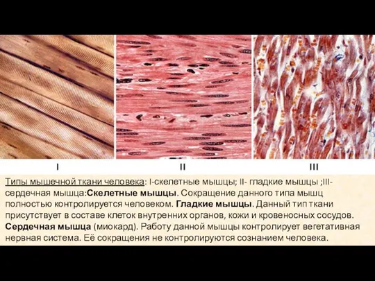 Типы мышечной ткани человека: I-скелетные мышцы; II- гладкие мышцы ;III-сердечная мышца:Скелетные мышцы.