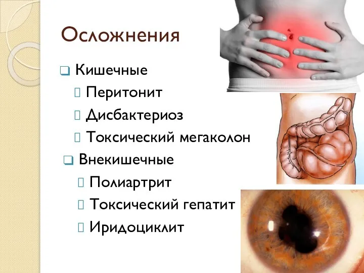 Осложнения Кишечные Перитонит Дисбактериоз Токсический мегаколон Внекишечные Полиартрит Токсический гепатит Иридоциклит