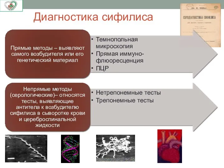 Диагностика сифилиса