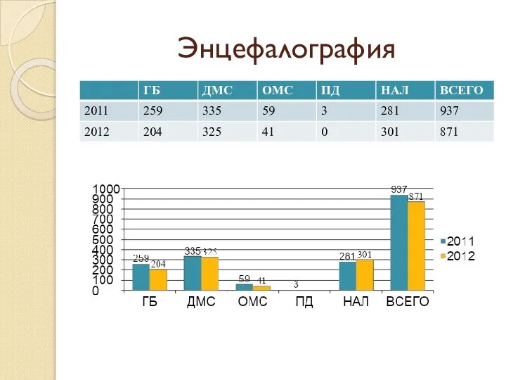 Энцефалография