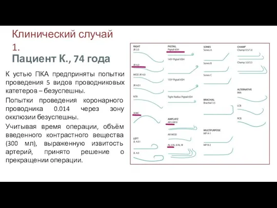 Клинический случай 1. К устью ПКА предприняты попытки проведения 5 видов проводниковых