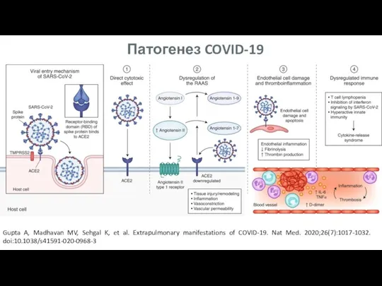 Патогенез COVID-19 Gupta A, Madhavan MV, Sehgal K, et al. Extrapulmonary manifestations