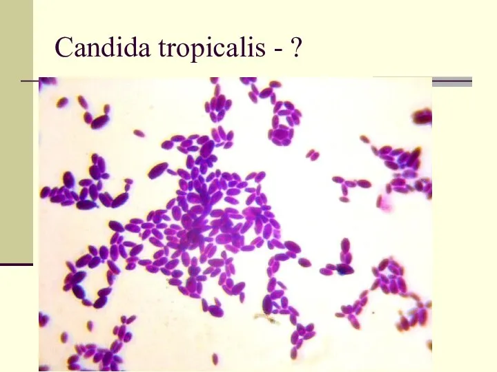 Candida tropicalis - ?