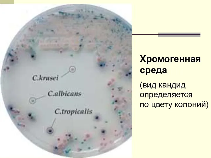 Хромогенная среда (вид кандид определяется по цвету колоний)