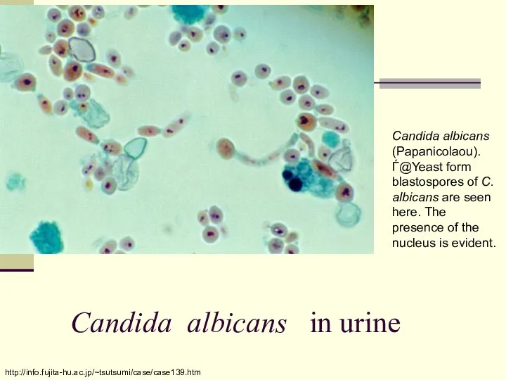 http://info.fujita-hu.ac.jp/~tsutsumi/case/case139.htm Candida albicans in urine Candida albicans (Papanicolaou).Ѓ@Yeast form blastospores of C.