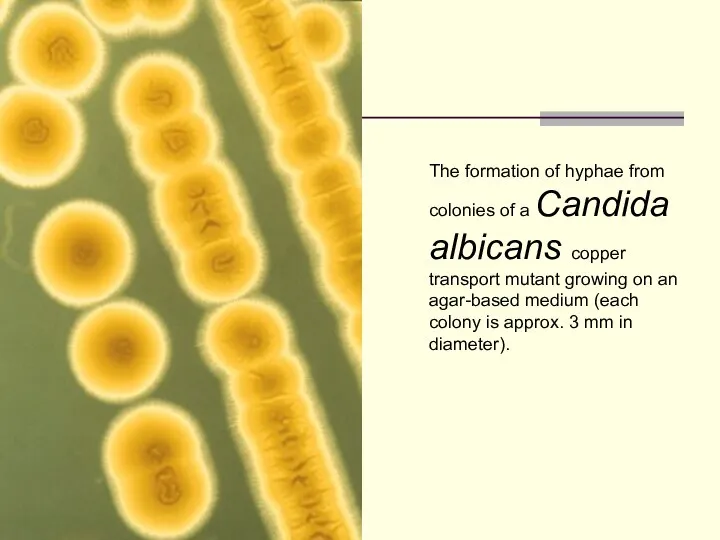 The formation of hyphae from colonies of a Candida albicans copper transport