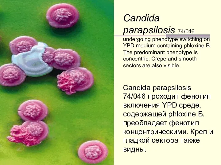 Candida parapsilosis 74/046 undergoing phenotype switching on YPD medium containing phloxine B.