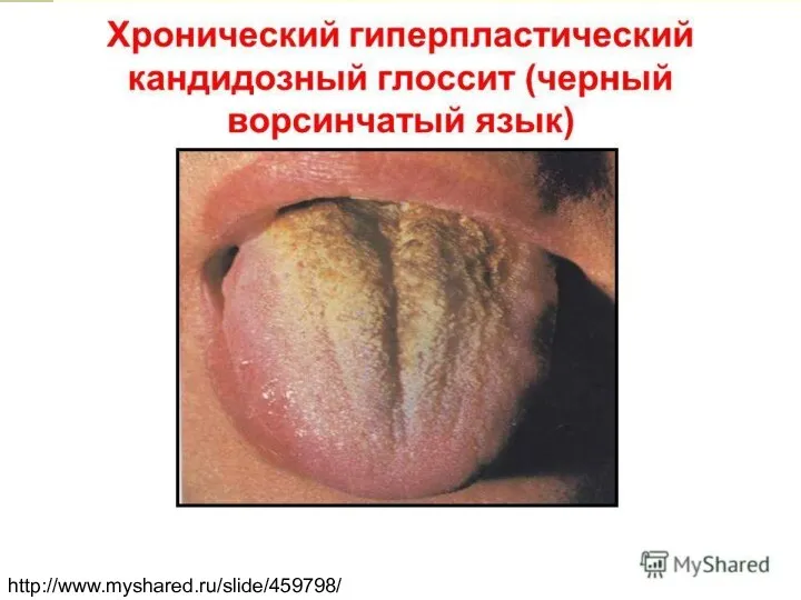 http://www.myshared.ru/slide/459798/