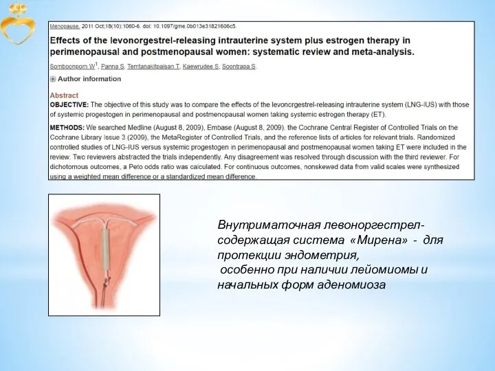 Внутриматочная левоноргестрел-содержащая система «Мирена» - для протекции эндометрия, особенно при наличии лейомиомы и начальных форм аденомиоза