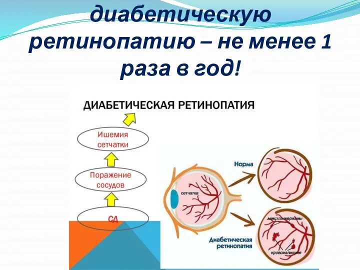 Скрининг на диабетическую ретинопатию – не менее 1 раза в год!