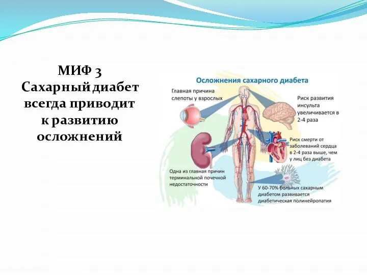 МИФ 3 Сахарный диабет всегда приводит к развитию осложнений